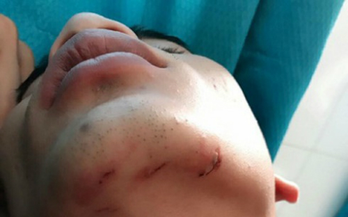 Hoa khôi trùm đường dây bán dâm nghìn đôla từng 'nói không với scandal'