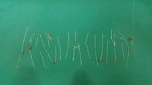 'Người mẫu kiện chồng đại gia bạo hành' nóng trên mạng xã hội